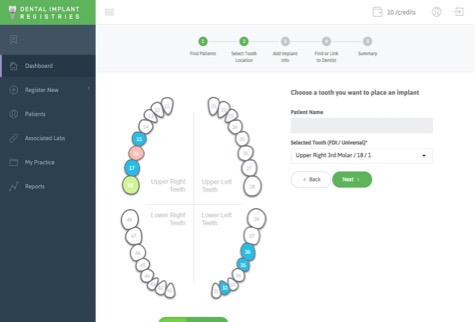 Dental implant registration screen